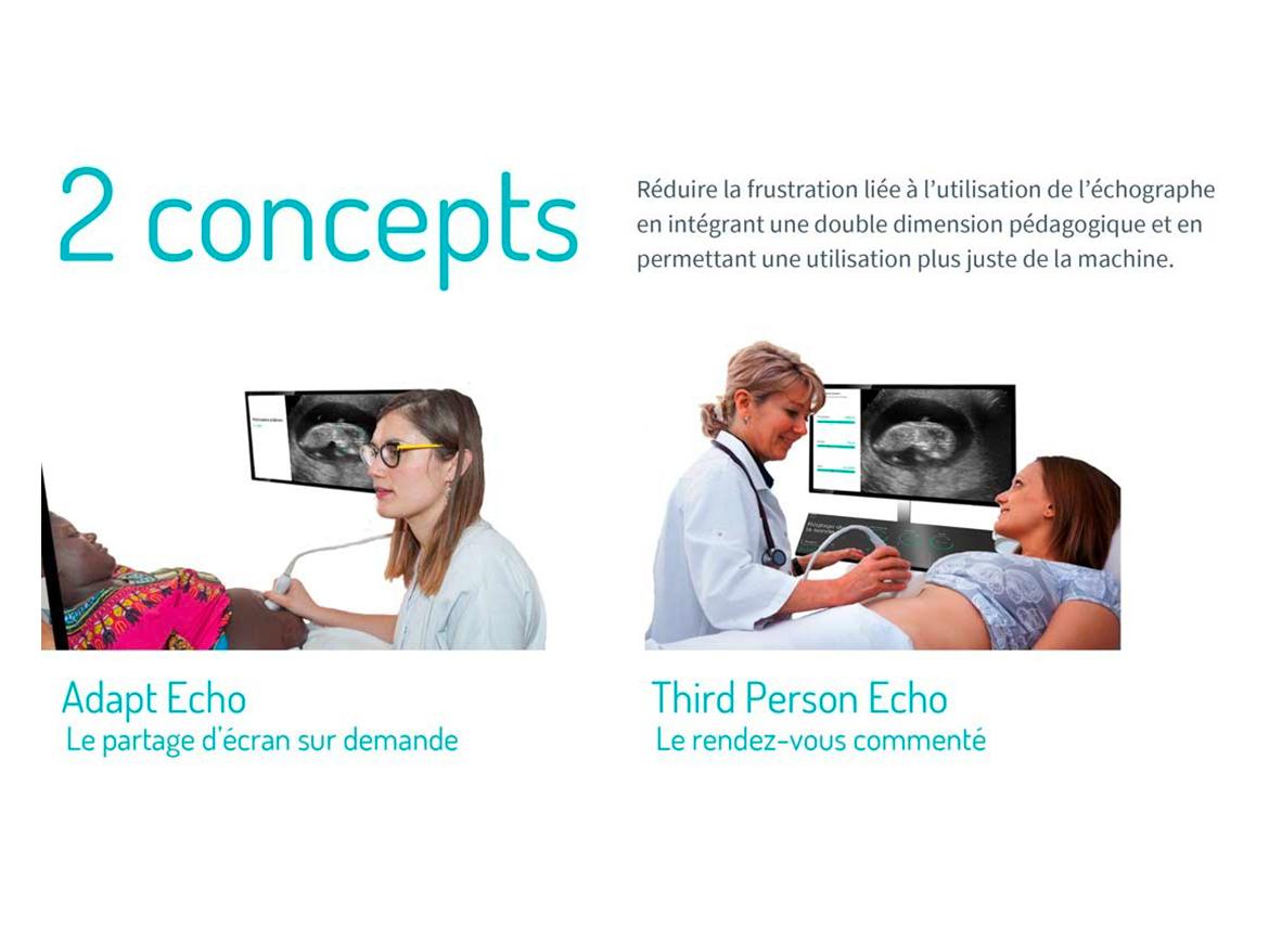 Concept de partage d’écran d’échographie sur demande par Morgane Boileau et Clémence Delin